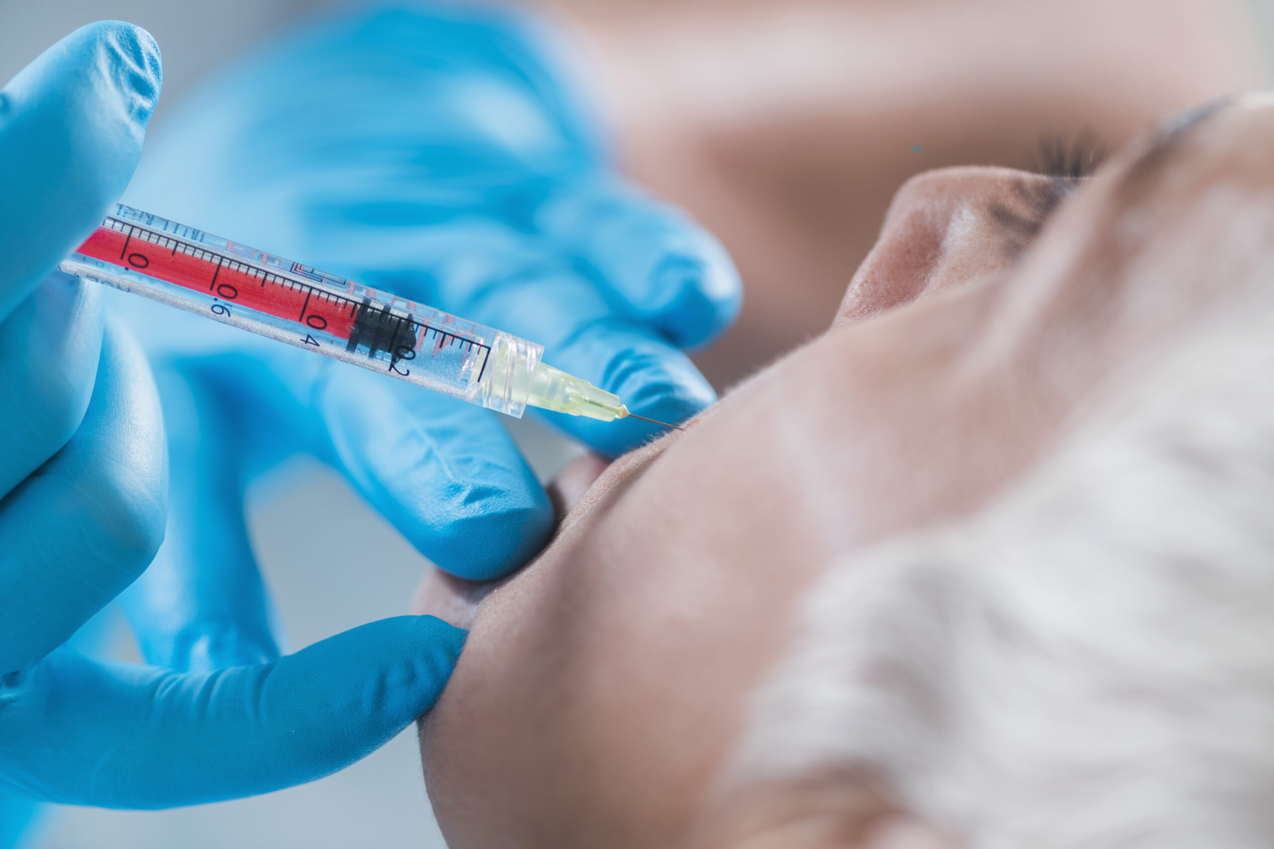 Hyaluronic acid injections. Beautiful mature woman receives hyaluronan injections for reducing cheek wrinkles. Anti-aging concept.